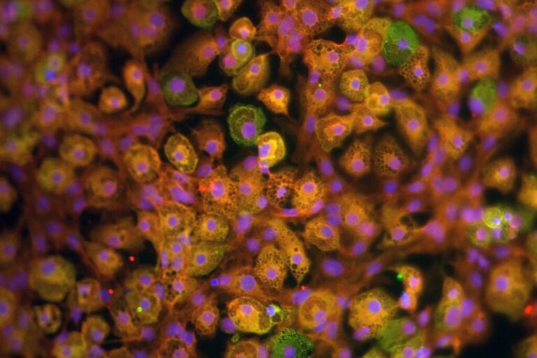 Read more about the article Llevamos décadas tratando de averiguar por qué engordamos. La ciencia cada vez lo tiene más claro