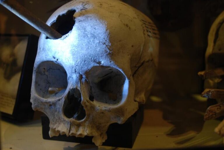 Read more about the article Los incas realizaban cirugías craneales con más éxito que los cirujanos del siglo XIX en EEUU. Y tenemos pruebas