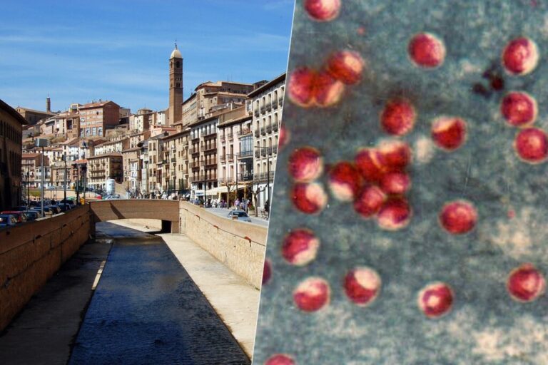Read more about the article 460 afectados y un parásito del agua: Tarazona registra el brote de gastroenteritis más grave de su tipo en España